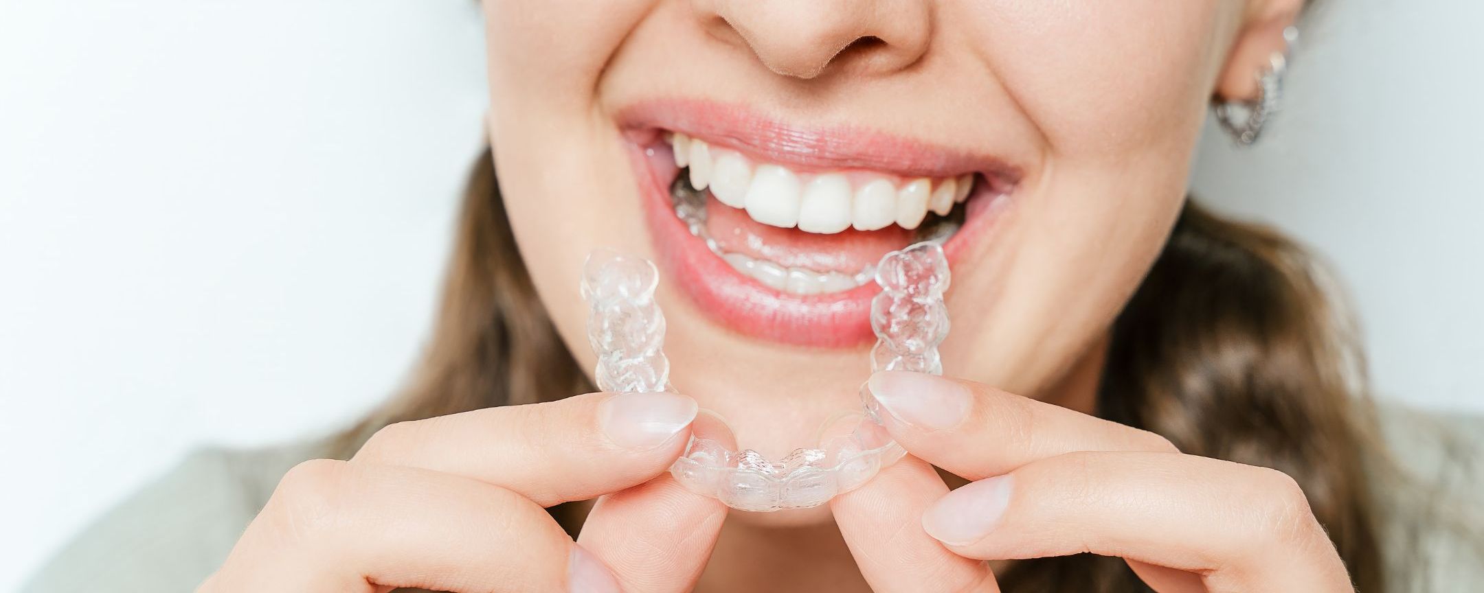 Teeth Straightening Open Day with Darren Bywater | Thursday 26th March 2026 