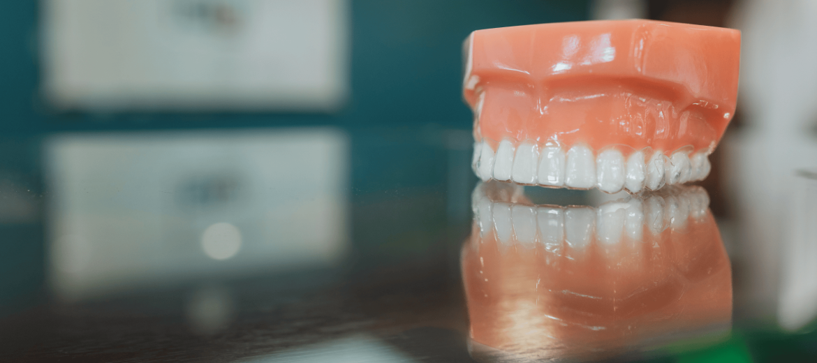 Invisible Braces 